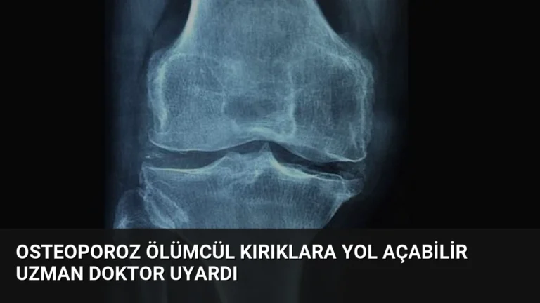 Osteoporoz Ölümcül Kırıklara Yol Açabilir Uzman Doktor Uyardı