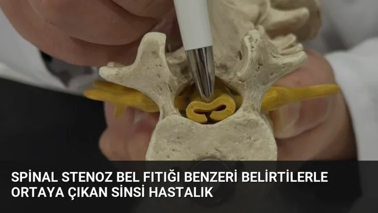 Spinal Stenoz Bel Fıtığı Benzeri Belirtilerle Ortaya Çıkan Sinsi Hastalık