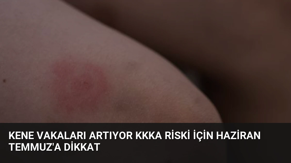 Kene Vakaları Artıyor KKKA Riski İçin Haziran Temmuz’a Dikkat