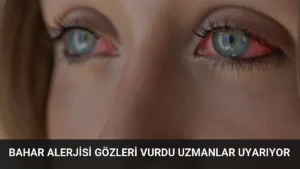 Bahar Alerjisi Gözleri Vurdu Uzmanlar Uyarıyor